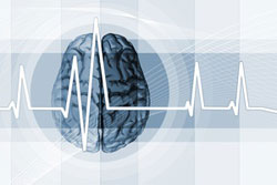 EEG